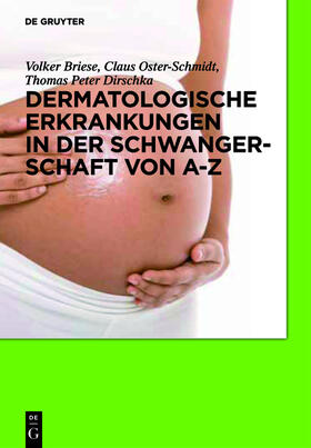 Briese / Oster-Schmidt / Dirschka |  Dermatologische Erkrankungen in der Schwangerschaft von A-Z | Buch |  Sack Fachmedien