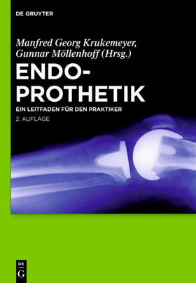 Krukemeyer / Möllenhoff |  Endoprothetik | eBook | Sack Fachmedien