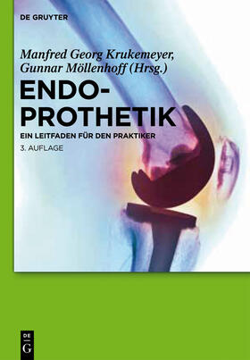 Möllenhoff / Krukemeyer |  Endoprothetik | Buch |  Sack Fachmedien