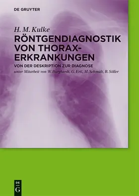 Kulke |  Röntgendiagnostik von Thoraxerkrankungen | Buch |  Sack Fachmedien