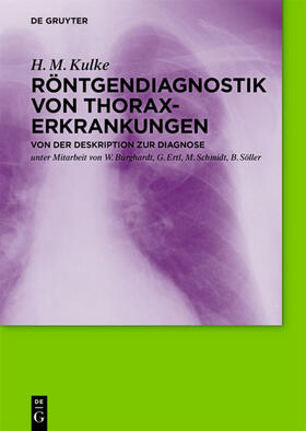Kulke |  Röntgendiagnostik von Thoraxerkrankungen | eBook | Sack Fachmedien