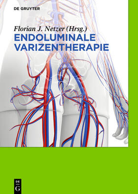 Netzer |  Endoluminale Varizentherapie | Buch |  Sack Fachmedien