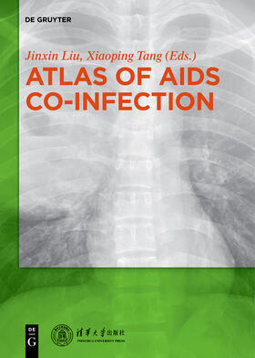 Jinxin / Xiaoping |  Atlas of AIDS Co-infection | Buch |  Sack Fachmedien