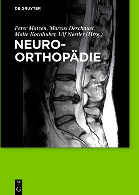 Matzen / Deschauer / Kornhuber |  Neuroorthopädie | eBook | Sack Fachmedien