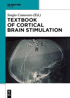 Canavero |  Textbook of Cortical Brain Stimulation | Buch |  Sack Fachmedien