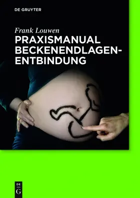 Louwen |  Praxismanual Beckenendlagenentbindung | eBook | Sack Fachmedien