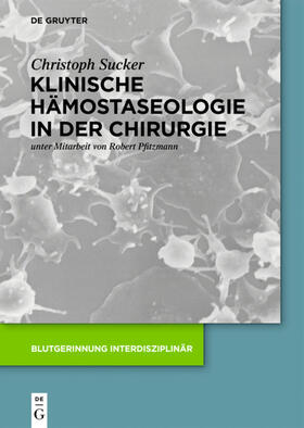 Sucker |  Klinische Hämostaseologie in der Chirurgie | eBook | Sack Fachmedien