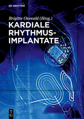 Osswald |  Kardiale Rhythmusimplantate | eBook | Sack Fachmedien