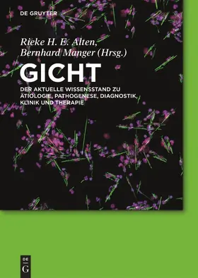 Alten / Manger |  Gicht | Buch |  Sack Fachmedien