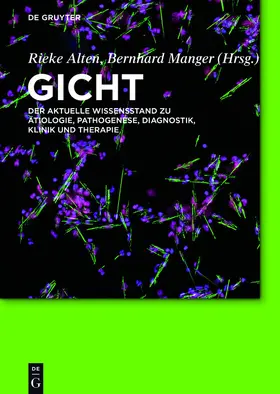 Alten / Manger | Gicht | E-Book | sack.de