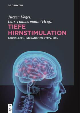 Voges / Timmermann |  Tiefe Hirnstimulation | Buch |  Sack Fachmedien