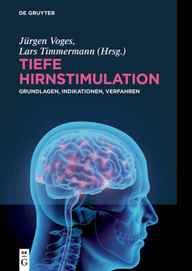 Voges / Timmermann |  Tiefe Hirnstimulation | eBook | Sack Fachmedien