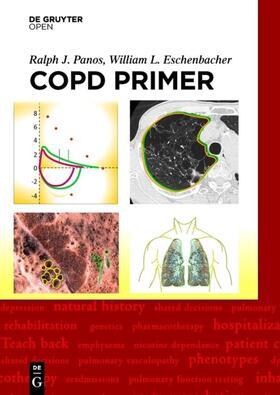 Eschenbacher / Panos |  A COPD Primer | Buch |  Sack Fachmedien