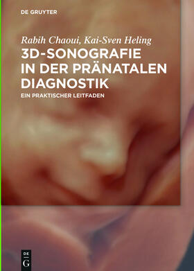 Chaoui / Heling |  3D-Sonografie in der pränatalen Diagnostik | Buch |  Sack Fachmedien
