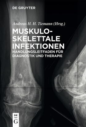 Tiemann |  Muskuloskelettale Infektionen | Buch |  Sack Fachmedien