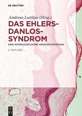 Luttkus |  Das Ehlers-Danlos-Syndrom | Buch |  Sack Fachmedien