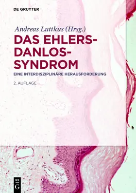 Luttkus |  Das Ehlers-Danlos-Syndrom | eBook | Sack Fachmedien