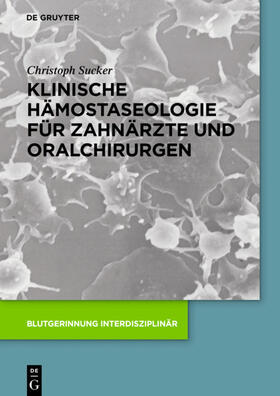 Sucker / Schüttler-Janikulla | Klinische Hämostaseologie für Zahnärzte und Oralchirurgen | Buch | 978-3-11-049096-1 | sack.de