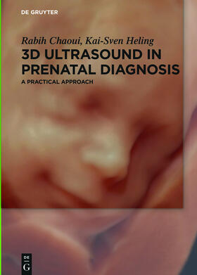 Chaoui / Heling |  3D Ultrasound in Prenatal Diagnosis | eBook | Sack Fachmedien