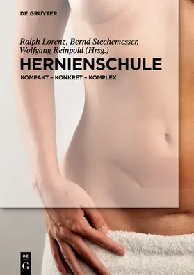 Lorenz / Stechemesser / Reinpold |  Hernienschule | eBook | Sack Fachmedien