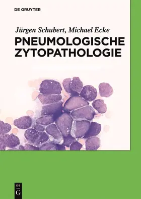 Schubert / Ecke |  Pneumologische Zytopathologie | Buch |  Sack Fachmedien