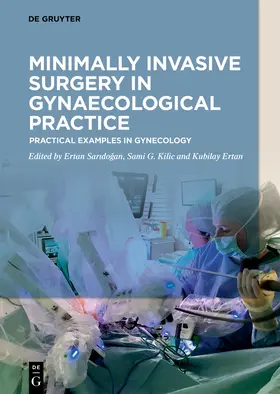 Saridogan / Saridogan / Ertan |  Minimally Invasive Surgery in Gynecological Practice | Buch |  Sack Fachmedien