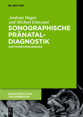 Hagen / Entezami |  Sonographische Pränataldiagnostik | Buch |  Sack Fachmedien