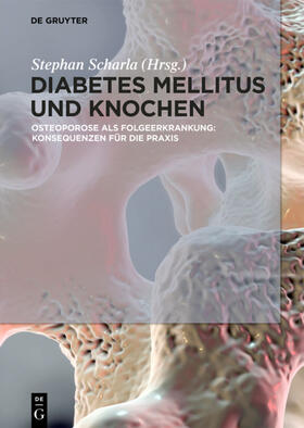 Scharla |  Diabetes Mellitus und Knochen | eBook | Sack Fachmedien