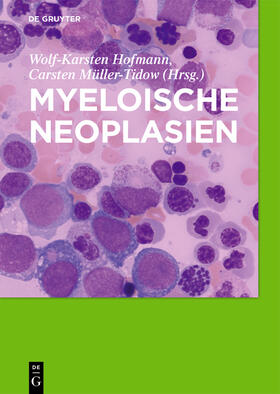 Müller-Tidow / Hofmann |  Myeloische Neoplasien | Buch |  Sack Fachmedien