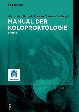 Herold / Schiedeck | Manual der Koloproktologie | E-Book | sack.de