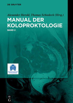 Herold / Schiedeck |  Manual der Koloproktologie | eBook |  Sack Fachmedien