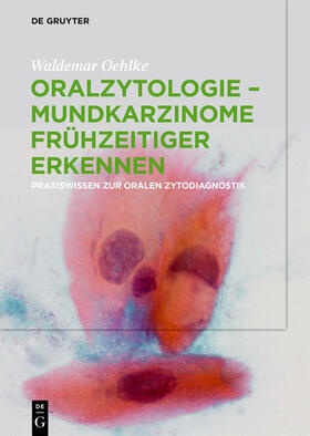 Oehlke |  Oralzytologie - Mundkarzinome frühzeitiger erkennen | Buch |  Sack Fachmedien