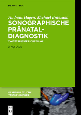 Entezami / Hagen | Sonographische Pränataldiagnostik | Buch | 978-3-11-064712-9 | sack.de