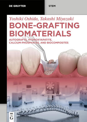 Oshida / Miyazaki | Bone-Grafting Biomaterials | Buch | 978-3-11-113666-0 | sack.de