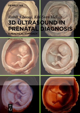 Chaoui / Heling |  3D Ultrasound in Prenatal Diagnosis | Buch |  Sack Fachmedien