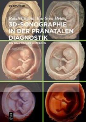 Chaoui / Heling |  3D-Sonographie in der pränatalen Diagnostik | eBook | Sack Fachmedien