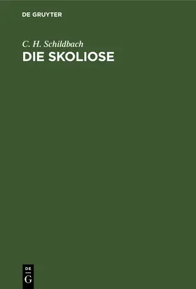 Schildbach |  Die Skoliose | Buch |  Sack Fachmedien