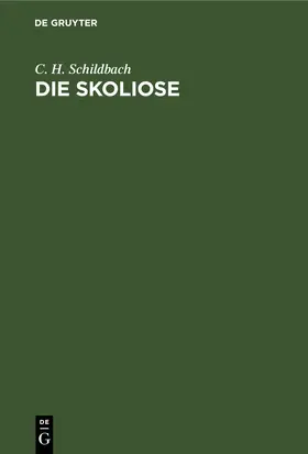 Schildbach |  Die Skoliose | eBook | Sack Fachmedien