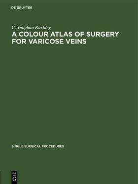 Ruckley |  A Colour Atlas of Surgery for Varicose Veins | Buch |  Sack Fachmedien
