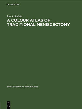 Smillie |  A Colour Atlas of Traditional Meniscectomy | Buch |  Sack Fachmedien