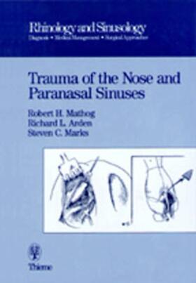 Robert H. Mathog |  Trauma of the Nose and Paranasal Sinuses | Buch |  Sack Fachmedien
