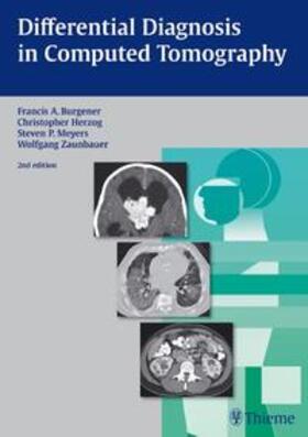 Burgener / Herzog / Kormano |  Differential Diagnosis in Computed Tomography | Buch |  Sack Fachmedien
