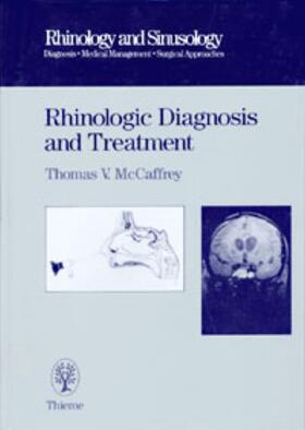 Thomas MCCaffrey |  Rhinologic Diagnosis and Treatment | Buch |  Sack Fachmedien