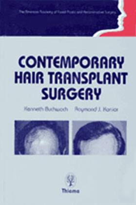 Kenneth A. Buchwach |  Contemporary Hair Transplant Surgery | Buch |  Sack Fachmedien