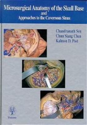 Chandranath Sen |  Microsurgical Anatomy of the Skull Base and Approaches to the Cavernous Sinus | Buch |  Sack Fachmedien