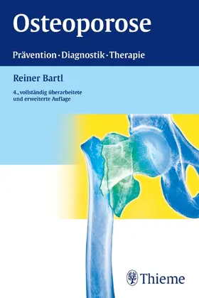 Bartl |  Osteoporose | Buch |  Sack Fachmedien