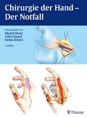 Merle / Dautel / Rehart |  Chirurgie der Hand | Buch |  Sack Fachmedien