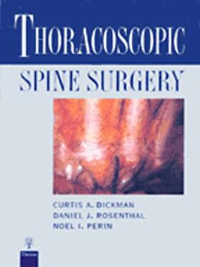 Curtis A. Dickman |  Thoracoscopic Spine Surgery | Buch |  Sack Fachmedien