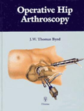J. W. Byrd |  Operative Hip Arthroscopy | Buch |  Sack Fachmedien