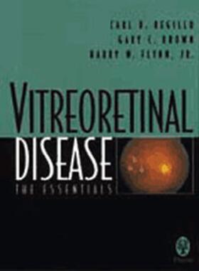 C. D. Regillo |  Vitreoretinal Disease | Buch |  Sack Fachmedien